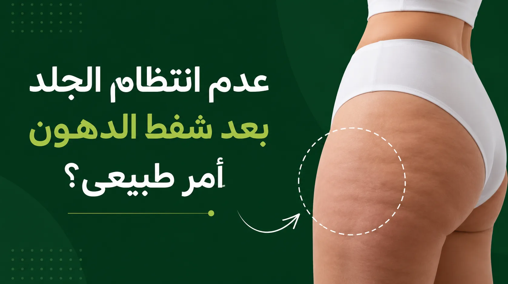هل عدم انتظام الجلد بعد شفط الدهون أمر طبيعي؟